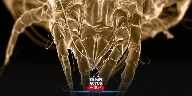 حشرات اختارت من مسام الجلد مكانا لها لتتكاثر