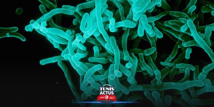 علماء يحذرون من تهديد صحّي عالمي بسبب بكتيريا ''الخناق''