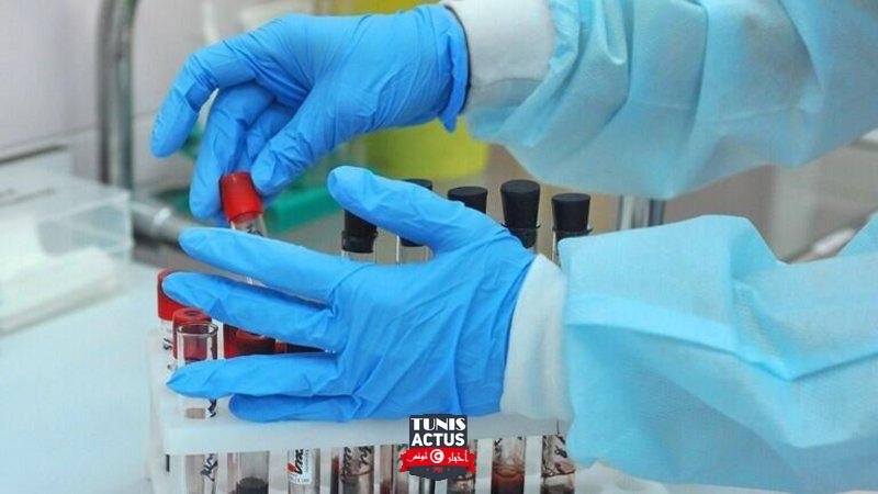 كورونا في 5 دول خلال 24 ساعة.. 1656 وفاة جديدة بالبرازيل و194 بال